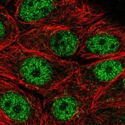 MORN2 Antibody, Novus Biologicals 25 &mu;L, Unlabeled:Antibodies, Polyclonal
